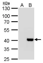 Anti-Macro H2A.2 antibody [N3C3] used in Western Blot (WB). GTX116234