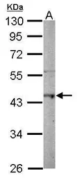 Anti-Macro H2A.2 antibody [N3C3] used in Western Blot (WB). GTX116234
