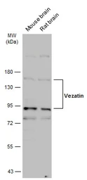 Anti-Vezatin antibody used in Western Blot (WB). GTX116240