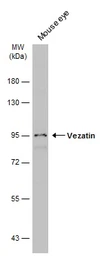 Anti-Vezatin antibody used in Western Blot (WB). GTX116240