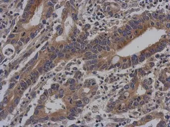 Anti-Vezatin antibody used in IHC (Paraffin sections) (IHC-P). GTX116240