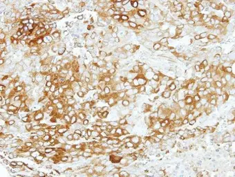 Anti-Vezatin antibody [N3C3] used in IHC (Paraffin sections) (IHC-P). GTX116241