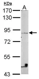 Anti-Vezatin antibody [N3C3] used in Western Blot (WB). GTX116241