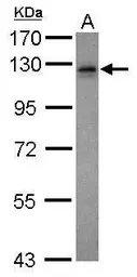Anti-Vezatin antibody [N3C3] used in Western Blot (WB). GTX116241