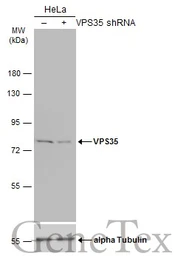 Anti-VPS35 antibody used in Western Blot (WB). GTX116260