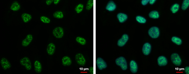 Anti-CHFR antibody used in Immunocytochemistry/ Immunofluorescence (ICC/IF). GTX116261