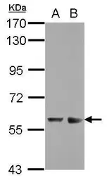 Anti-ZNF434 antibody used in Western Blot (WB). GTX116267