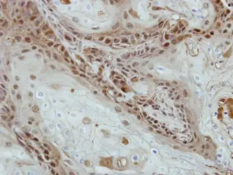 Anti-SOHLH2 antibody [N1C1] used in IHC (Paraffin sections) (IHC-P). GTX116268