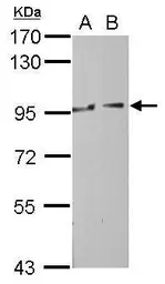 Anti-MOCOS antibody [N1N3] used in Western Blot (WB). GTX116279