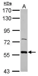 Anti-ZWILCH antibody [C1C3] used in Western Blot (WB). GTX116280