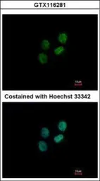 Anti-ZWILCH antibody used in Immunocytochemistry/ Immunofluorescence (ICC/IF). GTX116281