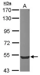 Anti-ZWILCH antibody used in Western Blot (WB). GTX116281
