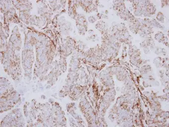 Anti-AspRS antibody [N1N3] used in IHC (Paraffin sections) (IHC-P). GTX116291
