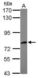 Anti-AspRS antibody [N1N3] used in Western Blot (WB). GTX116291