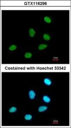Anti-P15RS antibody used in Immunocytochemistry/ Immunofluorescence (ICC/IF). GTX116296