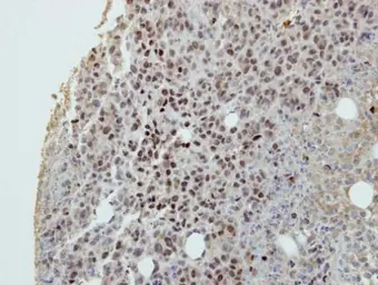 Anti-DIP13B antibody [C2C3], C-term used in IHC (Paraffin sections) (IHC-P). GTX116299
