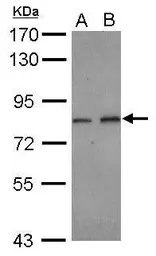 Anti-DIP13B antibody [C2C3], C-term used in Western Blot (WB). GTX116299