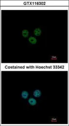 Anti-RCBTB1 antibody [N1C1] used in Immunocytochemistry/ Immunofluorescence (ICC/IF). GTX116302