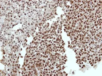 Anti-RCBTB1 antibody [N1C1] used in IHC (Paraffin sections) (IHC-P). GTX116302