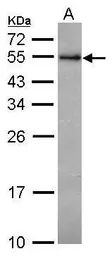 Anti-RCBTB1 antibody [N1C1] used in Western Blot (WB). GTX116302