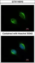 Anti-TYW1 antibody used in Immunocytochemistry/ Immunofluorescence (ICC/IF). GTX116310