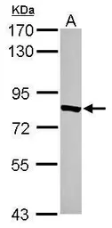 Anti-TYW1 antibody used in Western Blot (WB). GTX116310