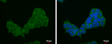 Anti-4E-BP1 antibody [N1C3-2] used in Immunocytochemistry/ Immunofluorescence (ICC/IF). GTX116315