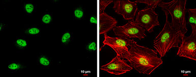 Anti-SIN3B antibody [N1N2], N-term used in Immunocytochemistry/ Immunofluorescence (ICC/IF). GTX116326