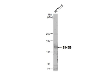 Anti-SIN3B antibody [N1N2], N-term used in Western Blot (WB). GTX116326