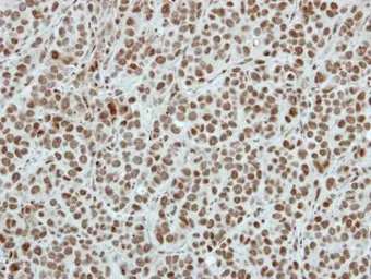 Anti-SIN3B antibody [N1N2], N-term used in IHC (Paraffin sections) (IHC-P). GTX116326