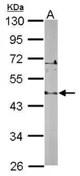 Anti-LDB2 antibody [N2C3] used in Western Blot (WB). GTX116344