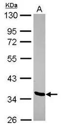 Anti-LDB2 antibody [N2C3] used in Western Blot (WB). GTX116344