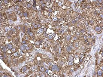 Anti-ThrRS antibody [N3C3] used in IHC (Paraffin sections) (IHC-P). GTX116359