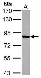 Anti-ThrRS antibody [N3C3] used in Western Blot (WB). GTX116359