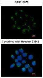 Anti-CNDP2 antibody [N3C3] used in Immunocytochemistry/ Immunofluorescence (ICC/IF). GTX116375