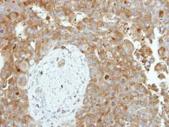 Anti-CNDP2 antibody [N3C3] used in IHC (Paraffin sections) (IHC-P). GTX116375