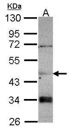 Anti-CNDP2 antibody [N3C3] used in Western Blot (WB). GTX116375