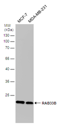 Anti-RAB33B antibody [N2C3] used in Western Blot (WB). GTX116390