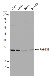 Anti-RAB33B antibody [N2C3] used in Western Blot (WB). GTX116390