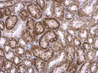 Anti-RAB33B antibody [N2C3] used in IHC (Paraffin sections) (IHC-P). GTX116390