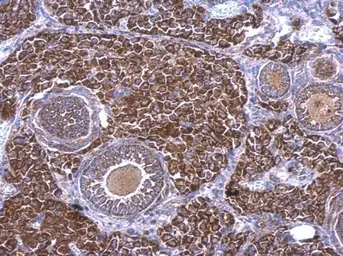 Anti-RAB33B antibody [N2C3] used in IHC (Paraffin sections) (IHC-P). GTX116390