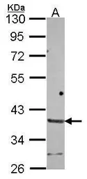 Anti-HAPLN2 antibody [N1C1] used in Western Blot (WB). GTX116393
