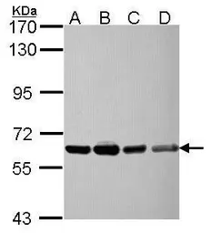 Anti-NXF3 antibody [C1C3] used in Western Blot (WB). GTX116398