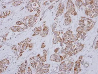 Anti-SLC25A23 antibody used in IHC (Paraffin sections) (IHC-P). GTX116402