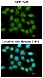 Anti-FAM84A antibody [N1C3] used in Immunocytochemistry/ Immunofluorescence (ICC/IF). GTX116408