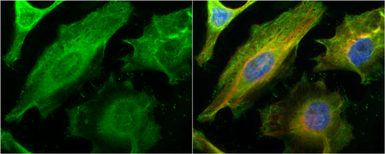 Anti-Galectin 1 antibody used in Immunocytochemistry/ Immunofluorescence (ICC/IF). GTX116411