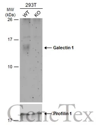 Anti-Galectin 1 antibody used in Western Blot (WB). GTX116411