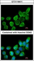 Anti-Galectin 1 antibody used in Immunocytochemistry/ Immunofluorescence (ICC/IF). GTX116411