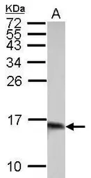 Anti-Galectin 1 antibody used in Western Blot (WB). GTX116411