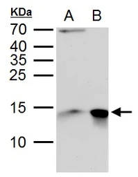 Anti-Galectin 1 antibody used in Western Blot (WB). GTX116411
